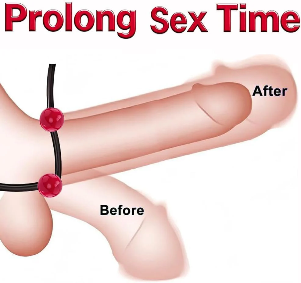 CrimsonFlex 9-Piece Adjustable Cock Ring Set - Image 2